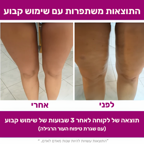 גלגל עיסוי להפחתת צלוליט - flexiroll המקורי