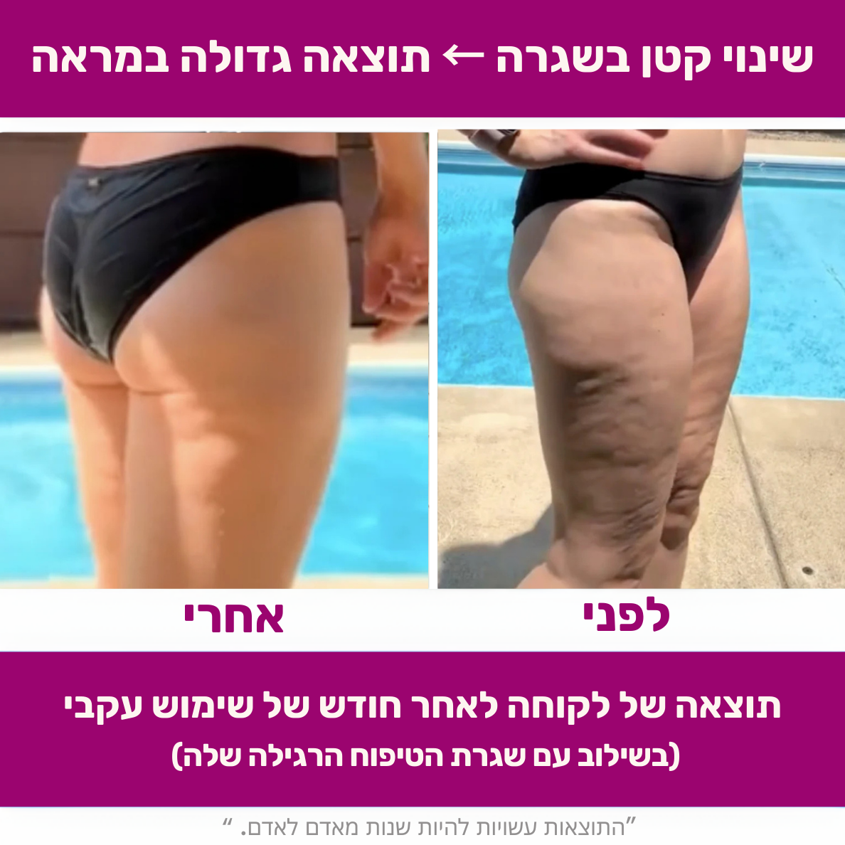 גלגל עיסוי להפחתת צלוליט - flexiroll המקורי