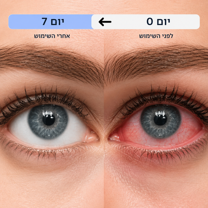 ‫ Easy Mask - מסכת חימום לעיניים להקלה על יובש ואי נוחות בעיניים ‬